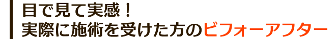目で見て実感! 実際に施術を受けた方のビフォーアフター